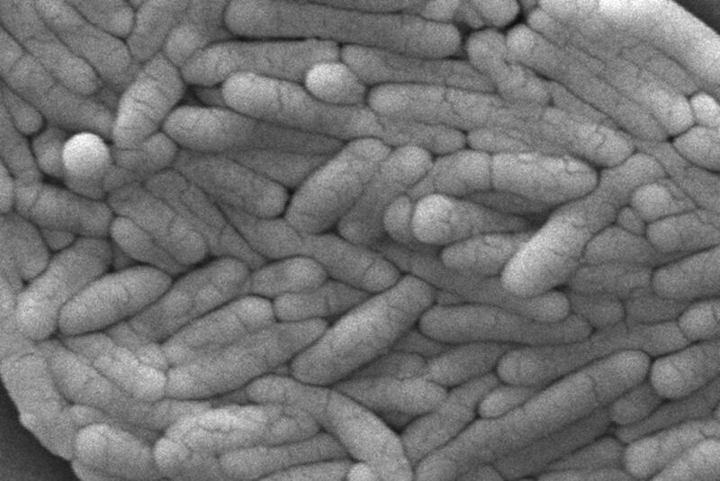 FILE - This 2009 electron microscope image provided by the Centers for Disease Control and Prevention shows a large group of Gram-negative Salmonella typhimurium bacteria that had been isolated from a pure culture. (Janice Haney Carr/CDC via AP, File)