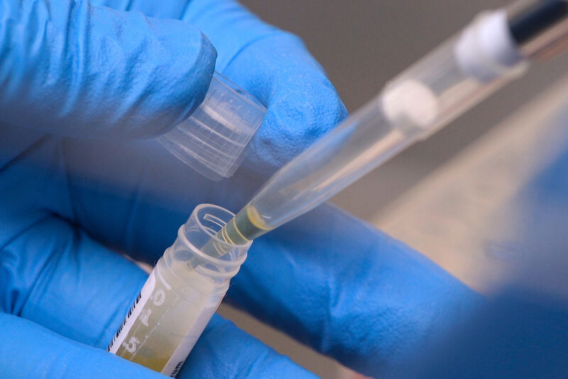 FILE - National Institute of Health researchers test patient samples in Bethesda, Md., on Nov. 20, 2019. (AP Photo/Federica Narancio, File)